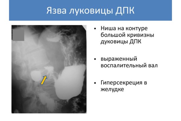 Как пополнить кошелек на кракене